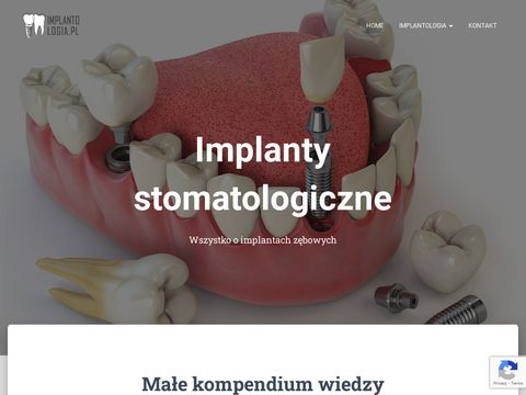 Implantologia.pl implanty stomatologiczne