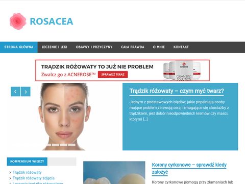 Rosacea.net.pl - jaka dieta w trądziku różowatym?