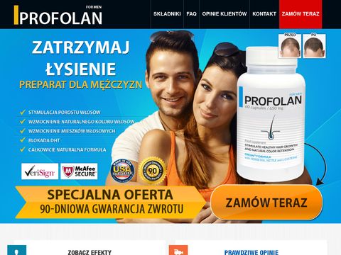 Profolan.pl - porost włosów